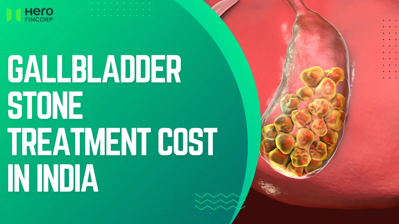 gallbladder stone surgery cost 